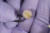 Fig 11. Light touches of tint on the occlusal are effectively placed using a very thin endodontic file.