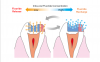 Fig 2. Sustainable fluoride release and recharge.